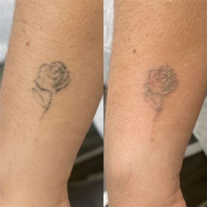 タトゥー入っている芸人まとめ｜意外な理由と芸能界の現実
